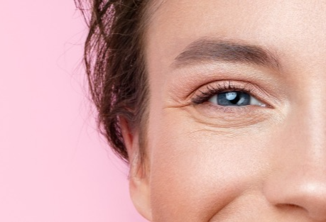 Botox for Crow’s Feet - What You Need to Know...