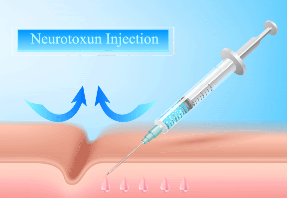 Understanding Botox: Beyond the Surface