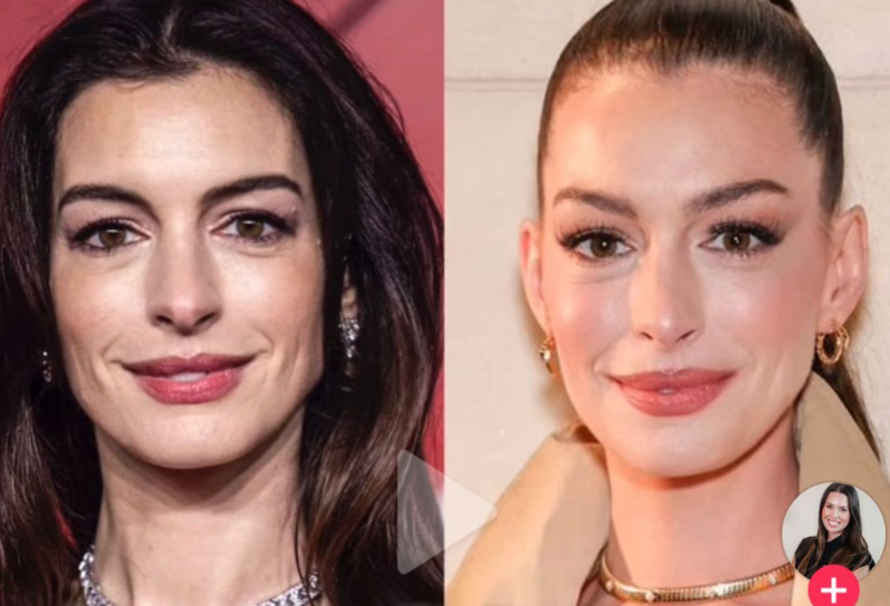 Did Anne Hathaway Have a Facelift? 